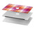 S3941 Plaid drapeau de la fierté lesbienne LGBT Etui Coque Housse pour MacBook Air 13″ (2022,2025) - A2681, A3113, A3240