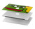 S3945 Pepe Love doigt du milieu Etui Coque Housse pour MacBook Pro 14 M1,M2,M3 (2021,2023) - A2442, A2779, A2992, A2918