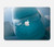 S1801 Béluga Sourire baleine Etui Coque Housse pour MacBook Air 15″ (2023,2024,2025) - A2941, A3114, A3241