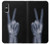 S3101 X-ray doigts Signe de paix Etui Coque Housse pour Sony Xperia 10 VI
