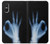 S3239 X-Ray Geste de la main OK Etui Coque Housse pour Sony Xperia 10 VI