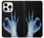 S3239 X-Ray Geste de la main OK Etui Coque Housse pour iPhone 16 pro