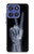 S3101 X-ray doigts Signe de paix Etui Coque Housse pour Motorola Moto G Stylus 5G (2025,2026), Edge 60 Stylus