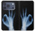S3239 X-Ray Geste de la main OK Etui Coque Housse pour iPhone 17 Pro, 18 Pro