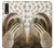 S3559 Sloth Pattern Etui Coque Housse pour Samsung Galaxy A70