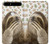 S3559 Sloth Pattern Etui Coque Housse pour Huawei Nexus 6P