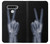 S3101 X-ray doigts Signe de paix Etui Coque Housse pour LG Stylo 6