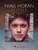 Niall Horan - Flicker [HL:255614]