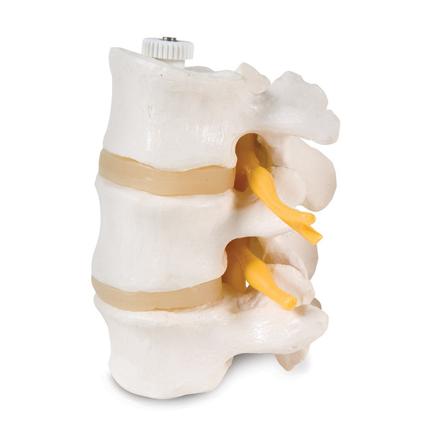 3 LUMBAR VERTEBRAE MODEL, FLEXIBLY MOUNTED