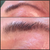 Brow hair growth after using Brow Gain... For Lashes Too