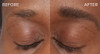 Eyebrow hair growth before and after using Brow Gain... For Lashes Too via Cheryl Simmons