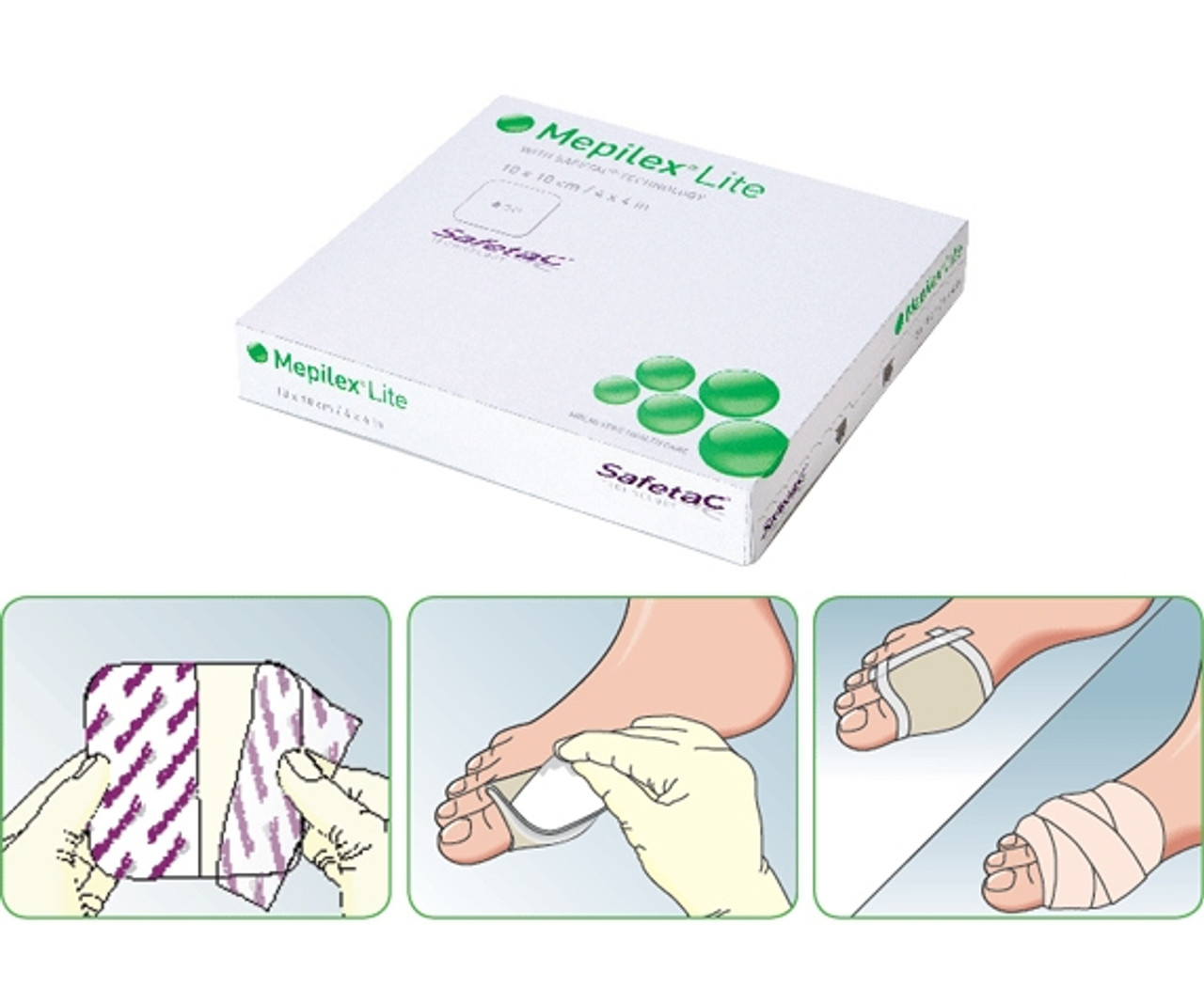 Molnlycke Mepilex Lite Self-adherent Soft Silicone Foam Dressing - Selles  Medical