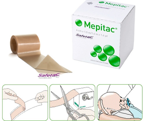 Molnlycke Mepitac - Soft Silicone Tape