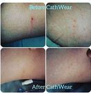 Cathwear Catheter Leg Bag Underwear - Leg Bag Holder for Men & Women - Catheter Supplies Compatible with Foley, Nephrostomy, Suprapubic & Biliary Catheters Holds (2) 600ml Leg Bags - Black - Large