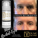 Young Ever After Max Revital-Eyes Natural Rapid Firming Eye Serum Puffy Eyes Treatment Instant Results, Eye Bags Treatment for Women & Men, Instant Eye Bag Remover Puffiness, Under Eye Tightening