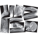 Roylco Broken Bones X-Ray Set, Projector Display Compatible - 15 X-Rays