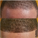 100% Real Human Hair Fibers - Conceal bald and thinning hair - Root touch up - Volumizer - Unisex (1.05 Ounce, Dark Brown) (1 Ounce (Pack of 1)