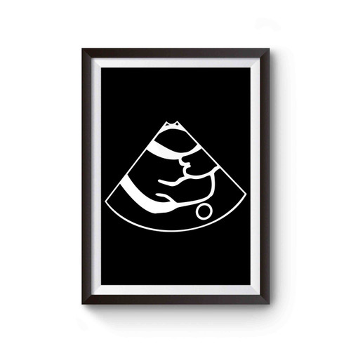 Ultrasound Science Pregnancy Announcement Cardiac Cardiology Poster