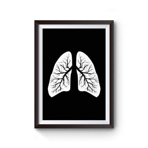 X-Ray Lungs Design Cystic Fibrosis Cf Poster X-Ray Lungs Design Cystic Fibrosis Cf Poster