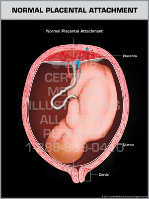 Exhibit of Normal Placental Attachment - Print Quality Instant Download