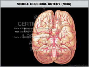 Exhibit of Middle Cerebral Artery (MCA) Exhibit of Middle Cerebral Artery (MCA)