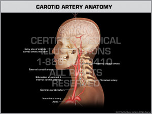 Carotid Artery Anatomy Carotid Artery Anatomy