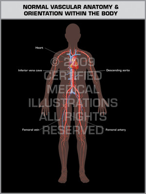 Exhibit of Normal Vascular Anatomy & Orientation (Female). Exhibit of Normal Vascular Anatomy & Orientation (Female).
