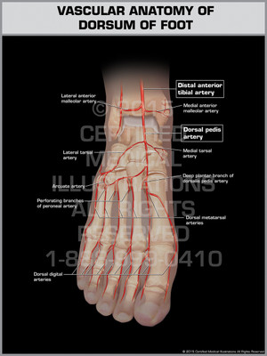 Exhibit of Vascular Anatomy of Dorsum of Foot. Exhibit of Vascular Anatomy of Dorsum of Foot.