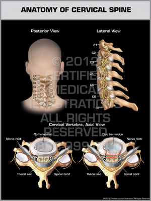 Exhibit of Anatomy of Cervical Spine. Exhibit of Anatomy of Cervical Spine.