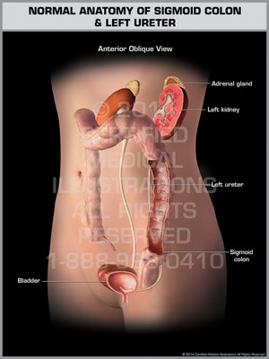 Exhibit of Anatomy of Sigmoid Colon & Left Ureter Female. Exhibit of Anatomy of Sigmoid Colon & Left Ureter Female.