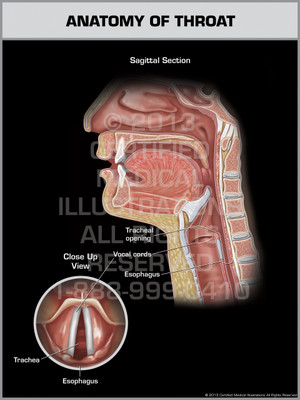 Exhibit of Anatomy of Throat. Exhibit of Anatomy of Throat.