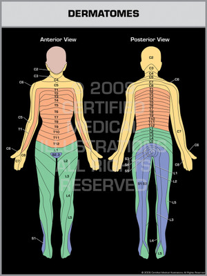 Exhibit of Dermatomes. Exhibit of Dermatomes.
