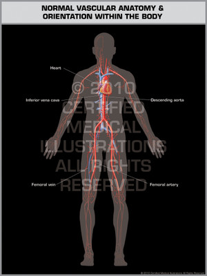 Exhibit of Normal Vascular Anatomy & Orientation (Male). Exhibit of Normal Vascular Anatomy & Orientation (Male).