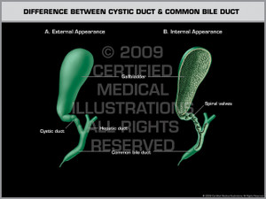 Difference Between Cystic Duct & Common Bile Duct