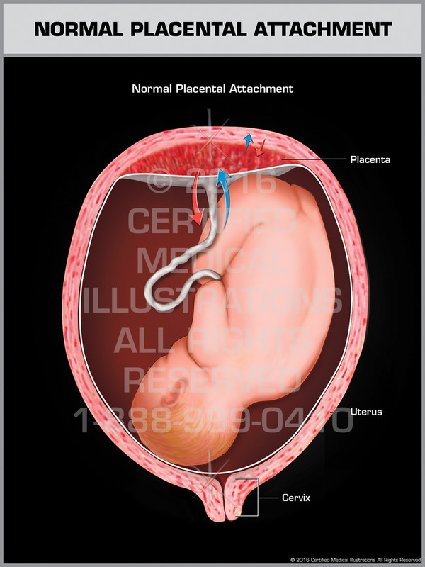 Exhibit of Normal Placental Attachment