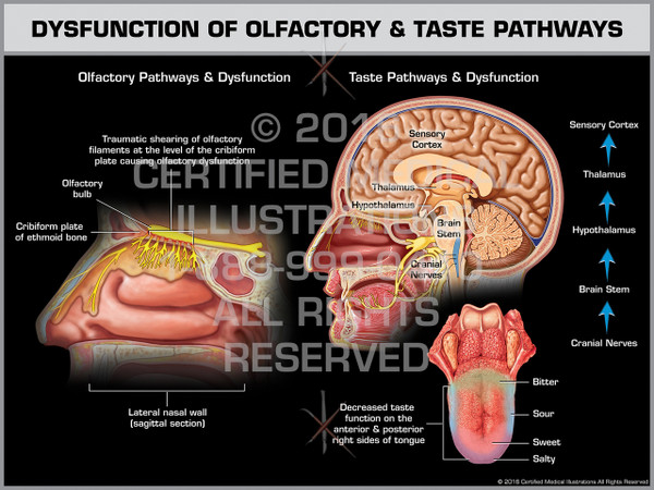 Exhibit of Dysfunction of Olfactory & Taste Pathways