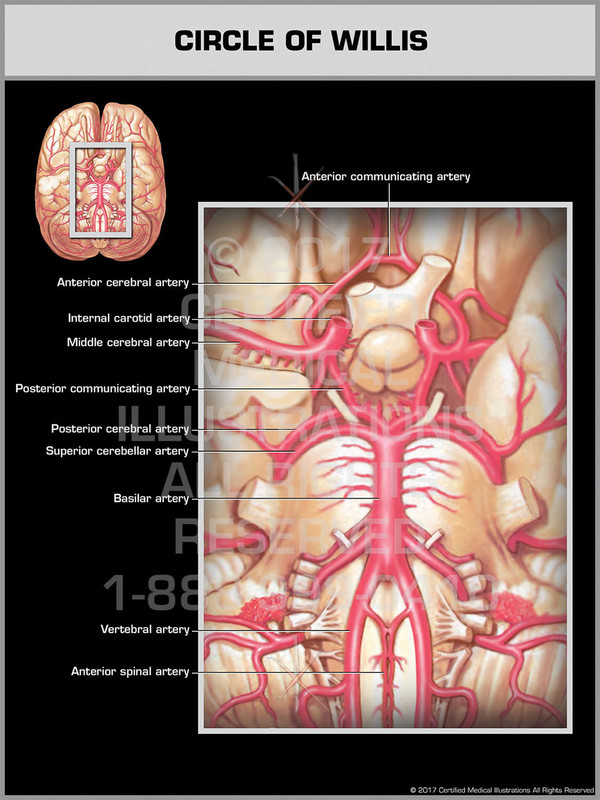 Exhibit of Circle of Willis