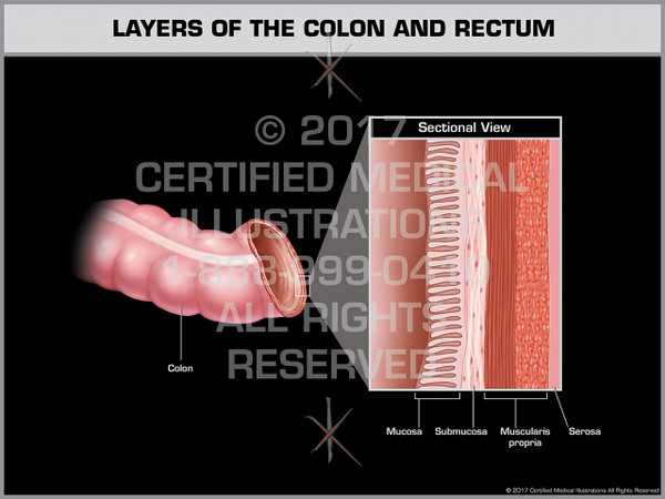 Layers of the Colon and Rectum- Print Quality Instant Download