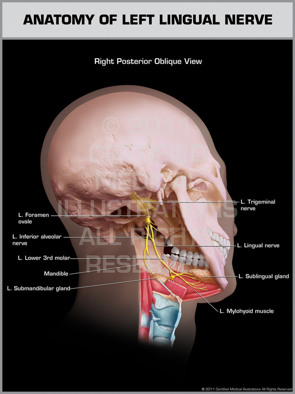 Exhibit of Anatomy of Left Lingual Nerve.