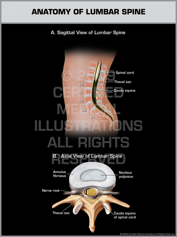 Exhibit of Anatomy of Lumbar Spine.