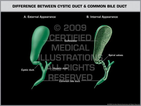 Difference Between Cystic Duct & Common Bile Duct