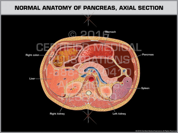 Exhibit of Normal Anatomy of Pancreas, Axial Section