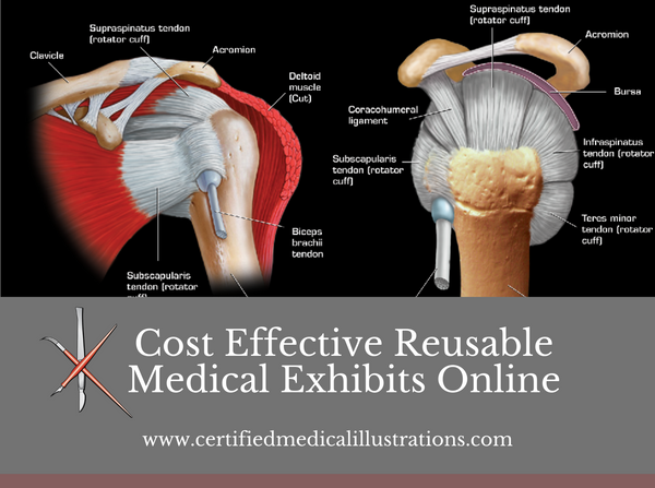 Cost Effective Reusable Medical Exhibits Online Cost Effective Reusable Medical Exhibits Online