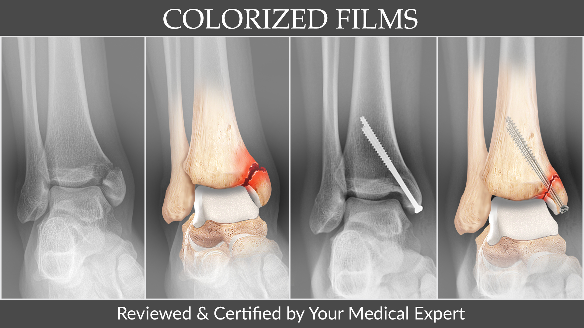 Colorized Films