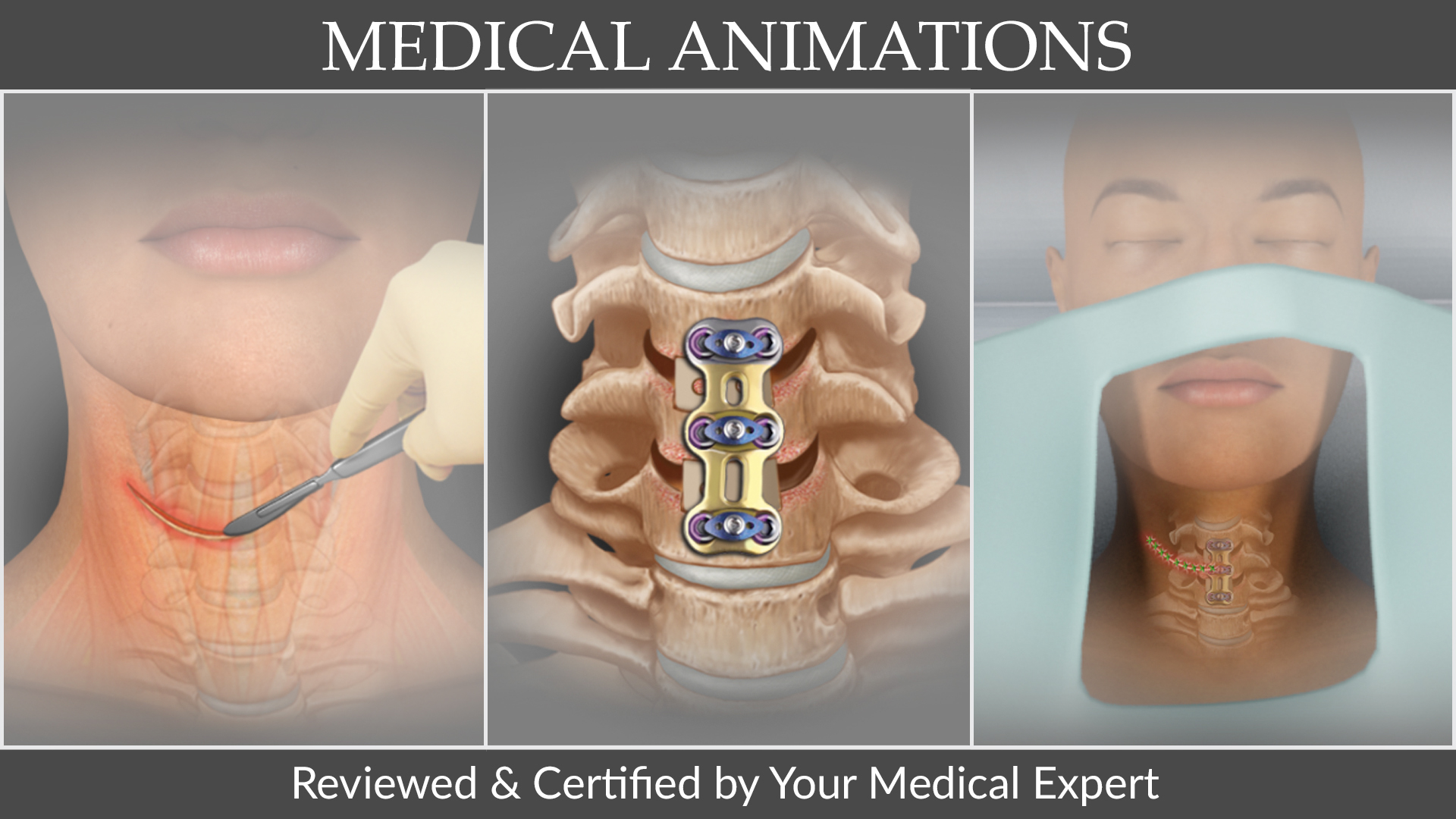 Medical Animations