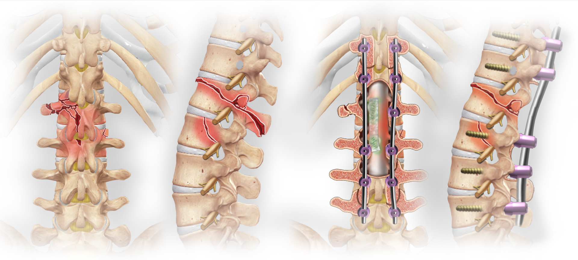 Medical Animations