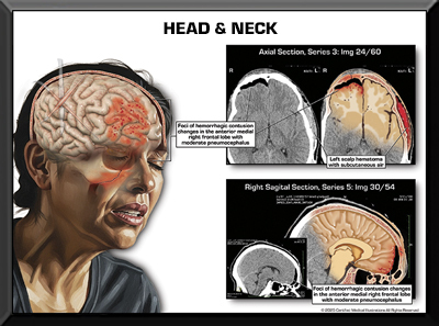 Colorized Films Head, Brain, Neck