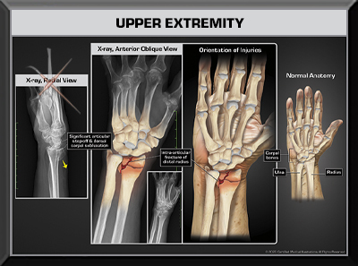 trial exhibits colorized arm sholder elbow wrist hand x-rays