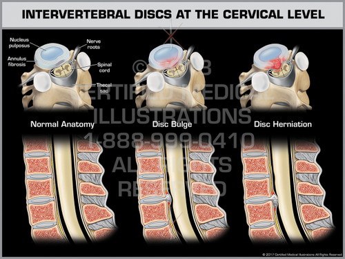 Intervertebral Discs at the Cervical Level - Print Quality Instant Download