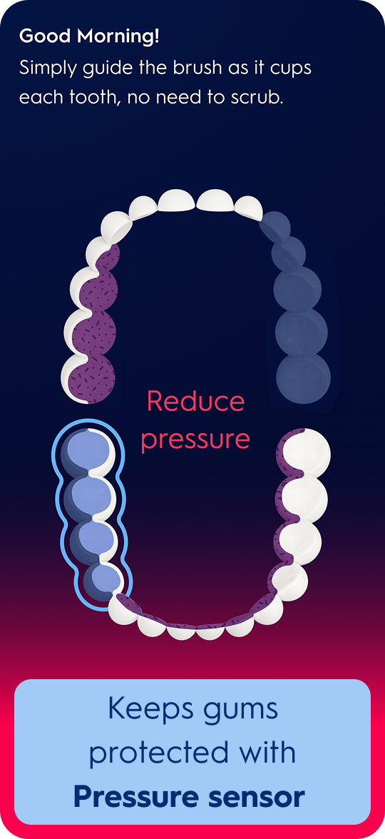 Protect your gums with the Pressure Sensor